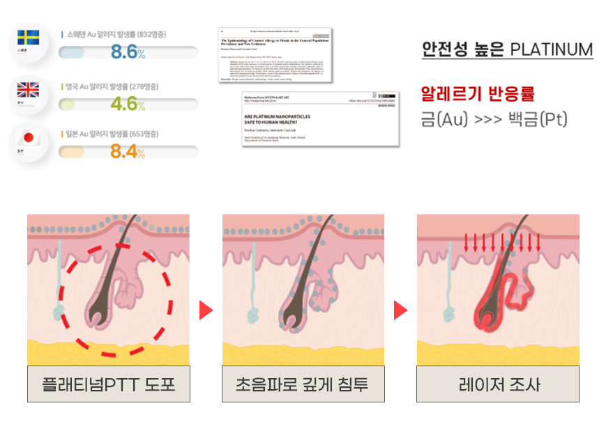 여드름