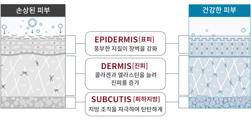 엑소좀