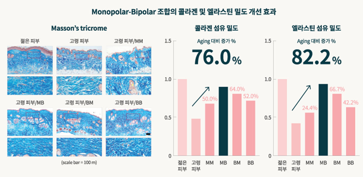 덴서티