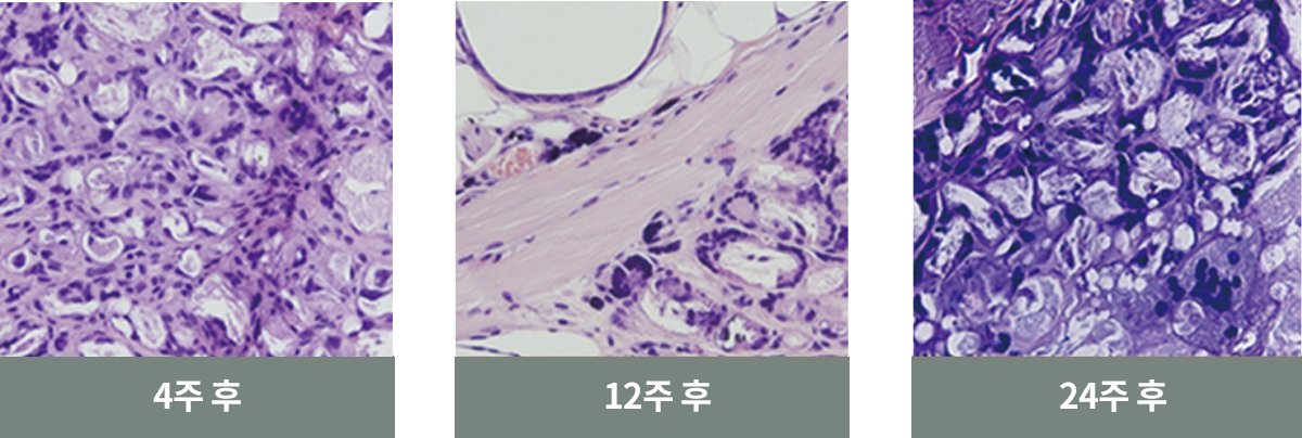 쥬베룩 볼륨