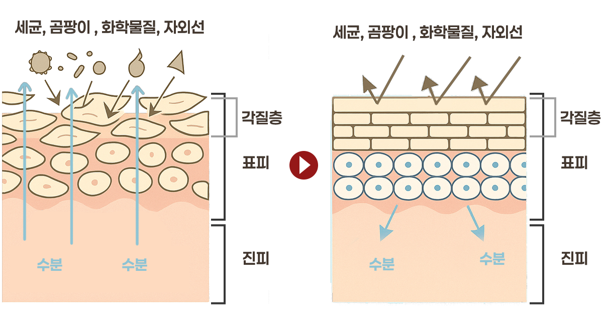 리쥬란