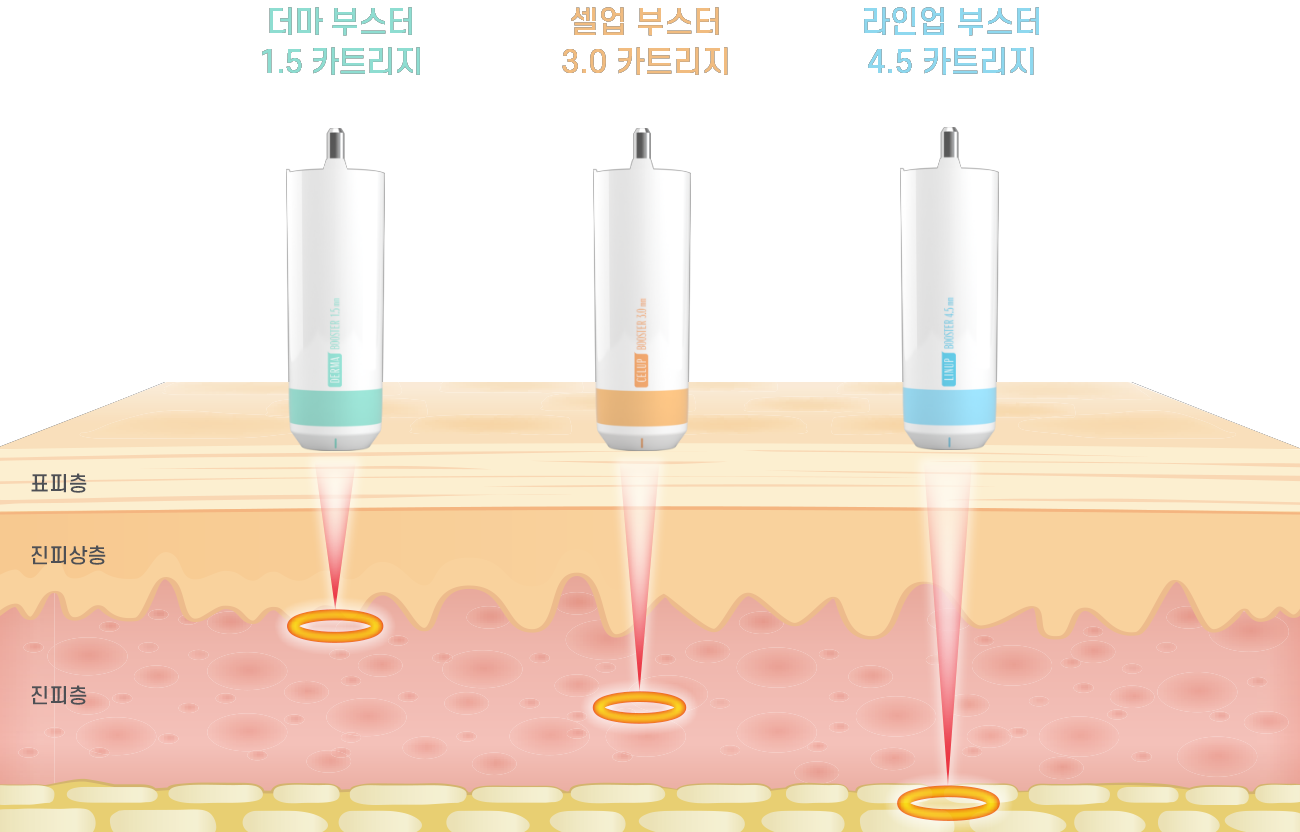 덴서티